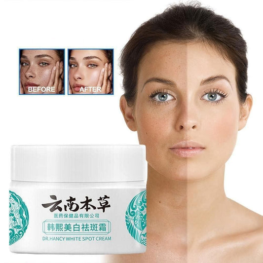 Japanese Melasma Cream