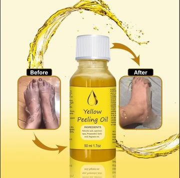 Yellow Peeling oil