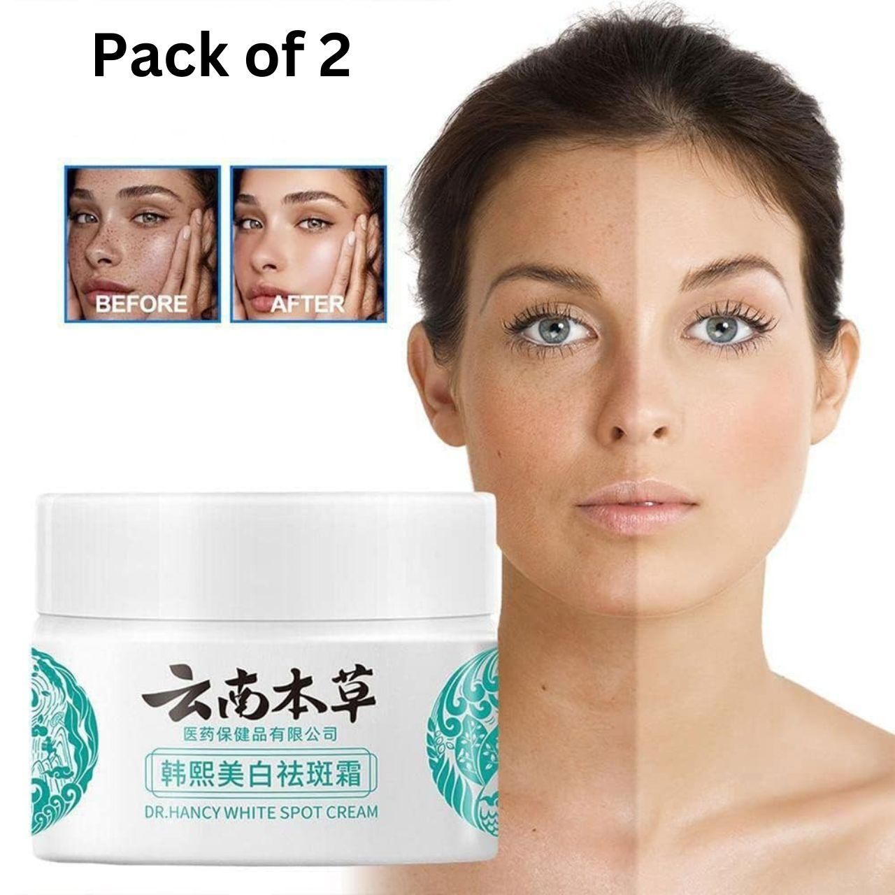 Japanese Melasma Cream (Pack of 2)