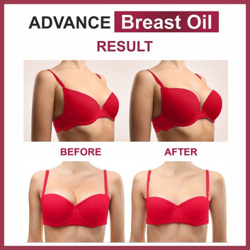 Advance Breast Oil